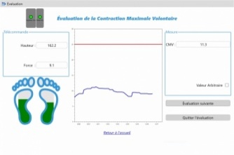 Illustration 1 : Evaluation CMV