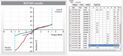 Graph 1 with its tables chart